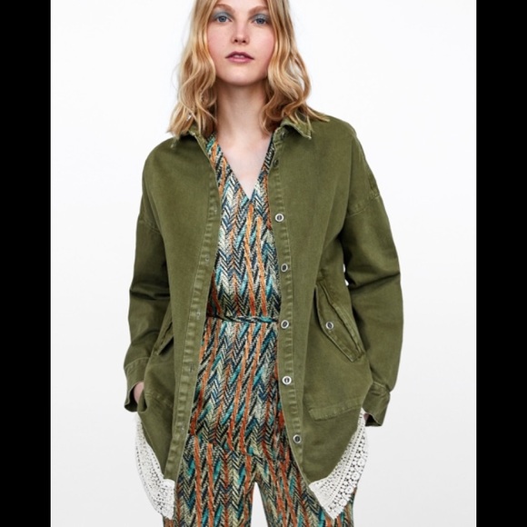 Zara Mixed Lace Overshirt - Picture 1 of 9